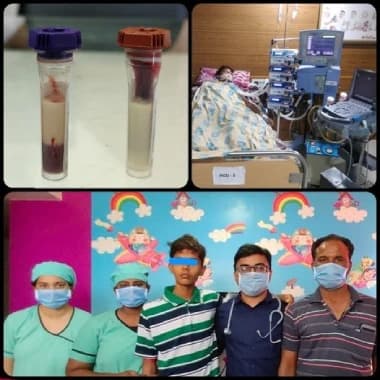 17 year old boy with serum triglycerides was admitted
